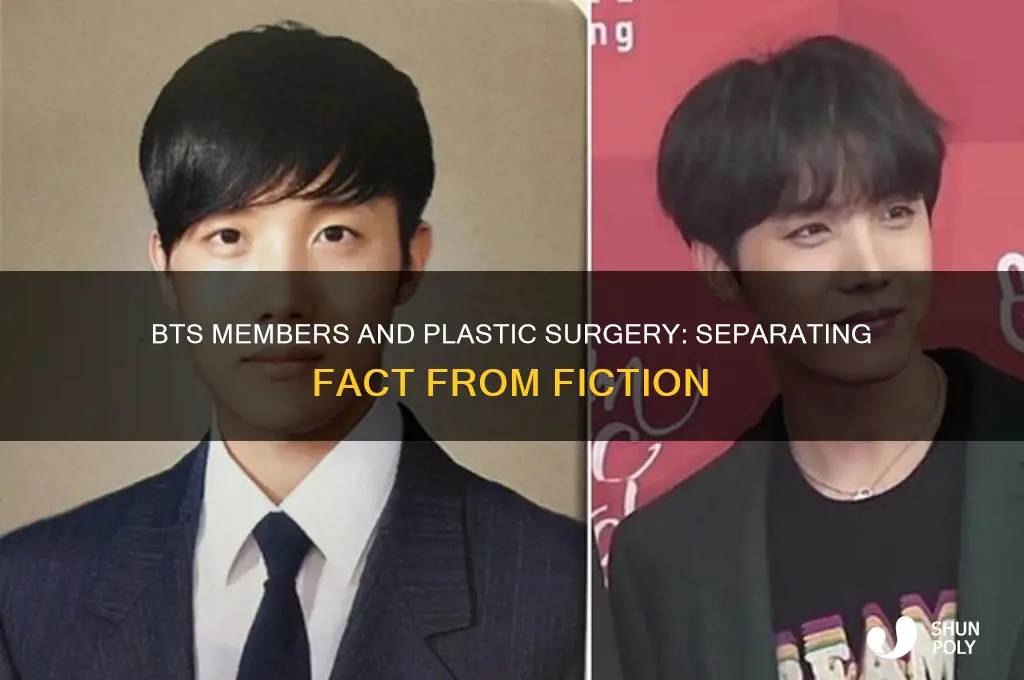 did any bts members get plastic surgery
