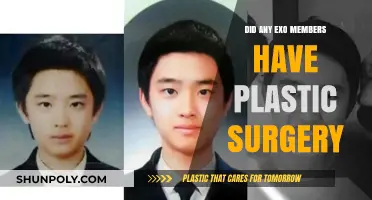 EXO Members and Plastic Surgery: Unveiling the Truth Behind the Rumors
