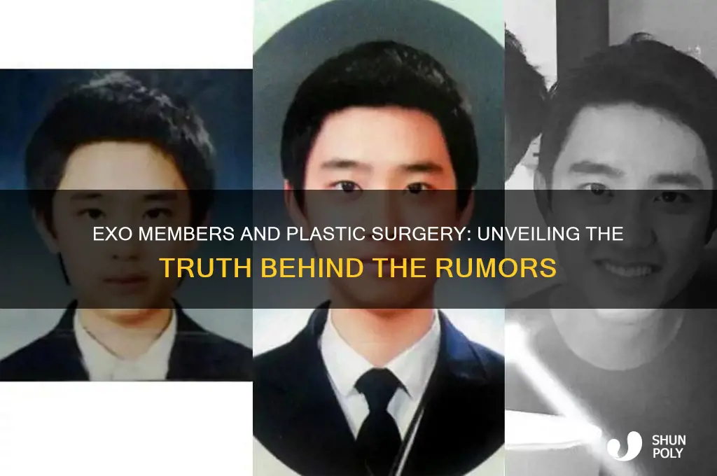 did any exo members have plastic surgery