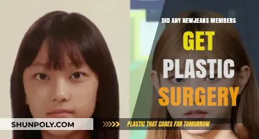 NewJeans Members' Plastic Surgery Speculations: Fact or Fiction?