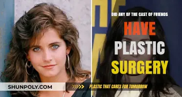 Friends Cast Plastic Surgery: Fact-Checking Rumors and Speculations