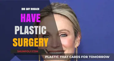 Amy Robach's Transformation: Plastic Surgery Rumors Explored and Debunked