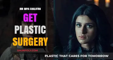 Anya Chalotra Plastic Surgery Rumors: Fact or Fiction?