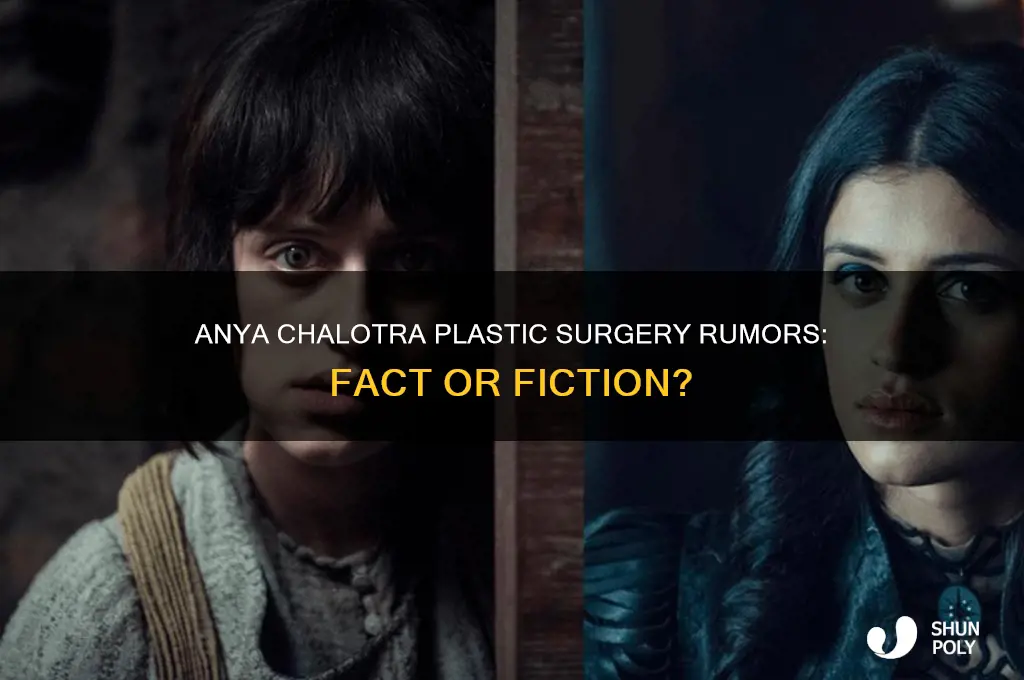 did anya chalotra get plastic surgery
