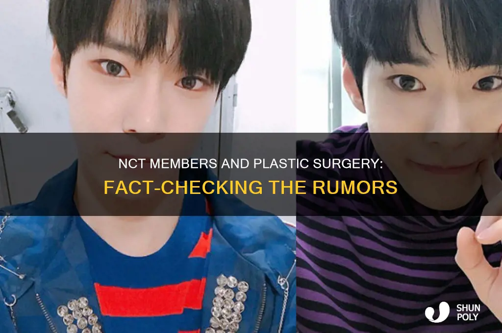 did anyone in nct get plastic surgery