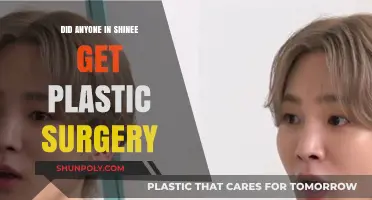 SHINee Members and Plastic Surgery: Fact-Checking the Rumors