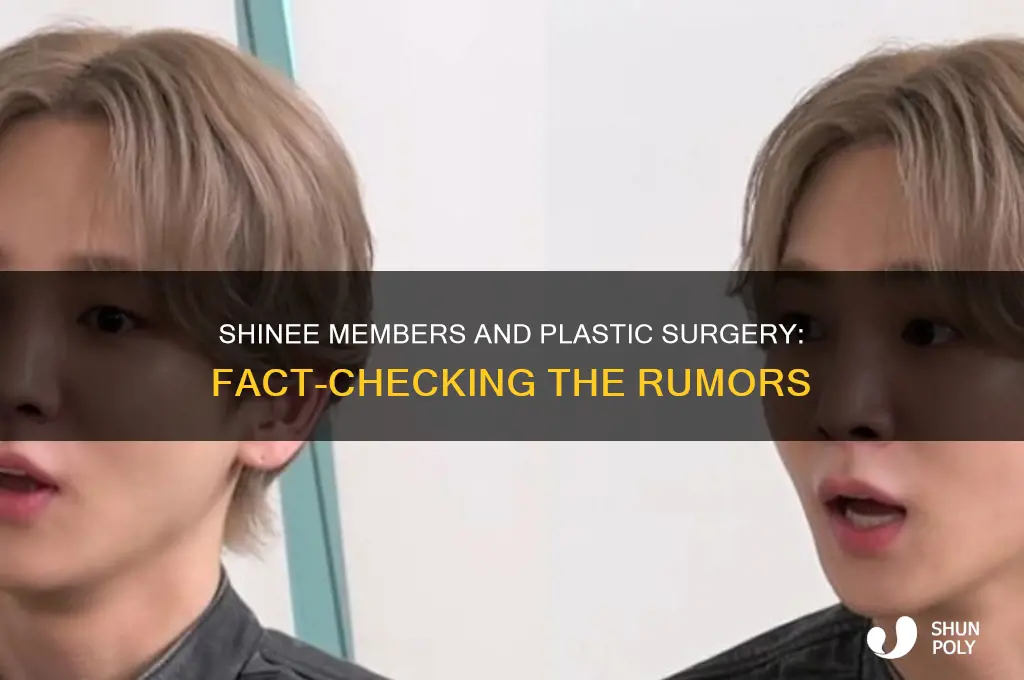 did anyone in shinee get plastic surgery