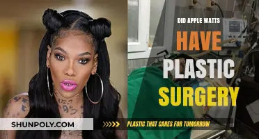 Did Apple Watts Undergo Plastic Surgery? Uncovering the Truth