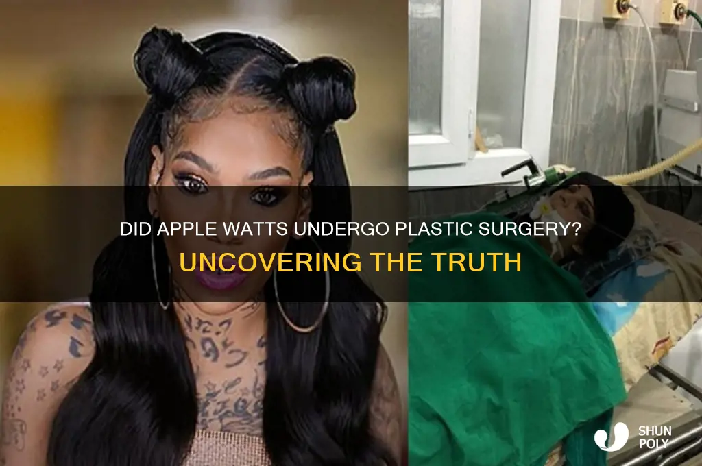 did apple watts have plastic surgery