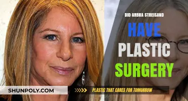 Did Barbra Streisand Undergo Plastic Surgery? Unveiling the Truth
