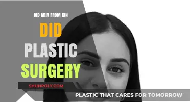 Aria from Xin Plastic Surgery Rumors: Fact or Fiction?