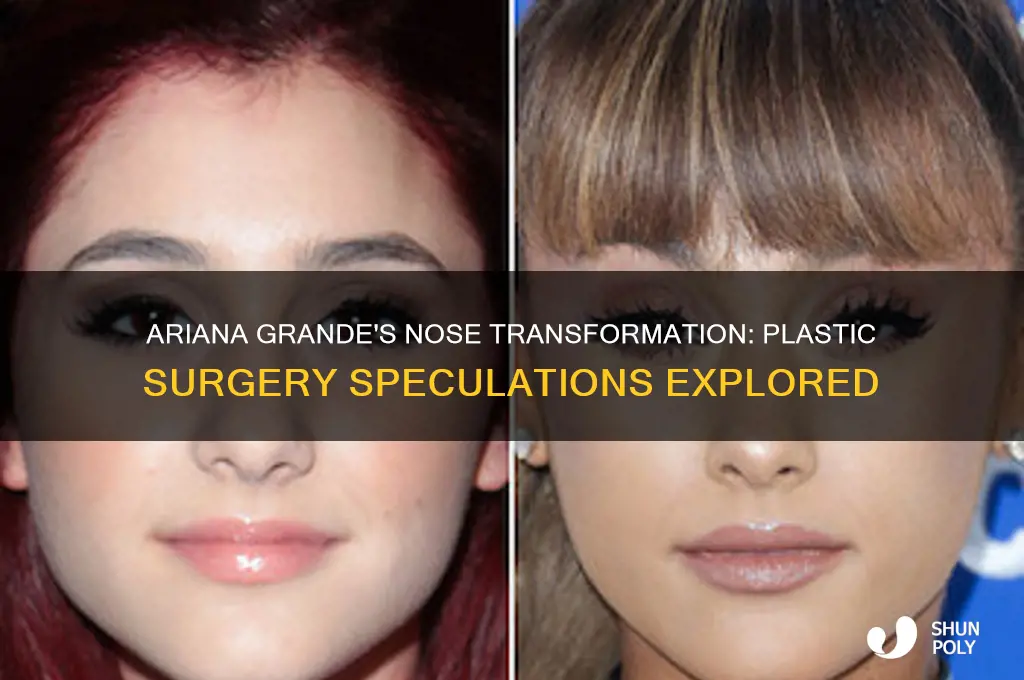 did ariana grande get plastic surgery nose