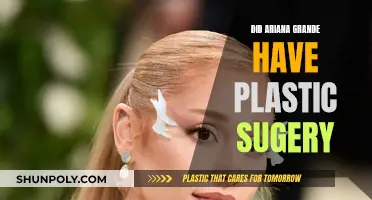 Ariana Grande's Transformation: Plastic Surgery or Natural Evolution?