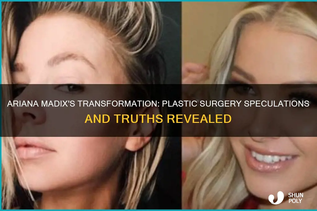 did ariana madix get plastic surgery