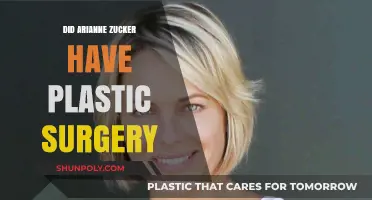 Arianne Zucker's Transformation: Plastic Surgery Speculations and Truths Revealed
