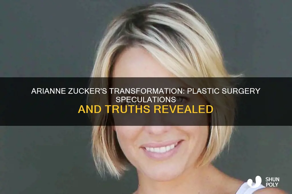 did arianne zucker have plastic surgery