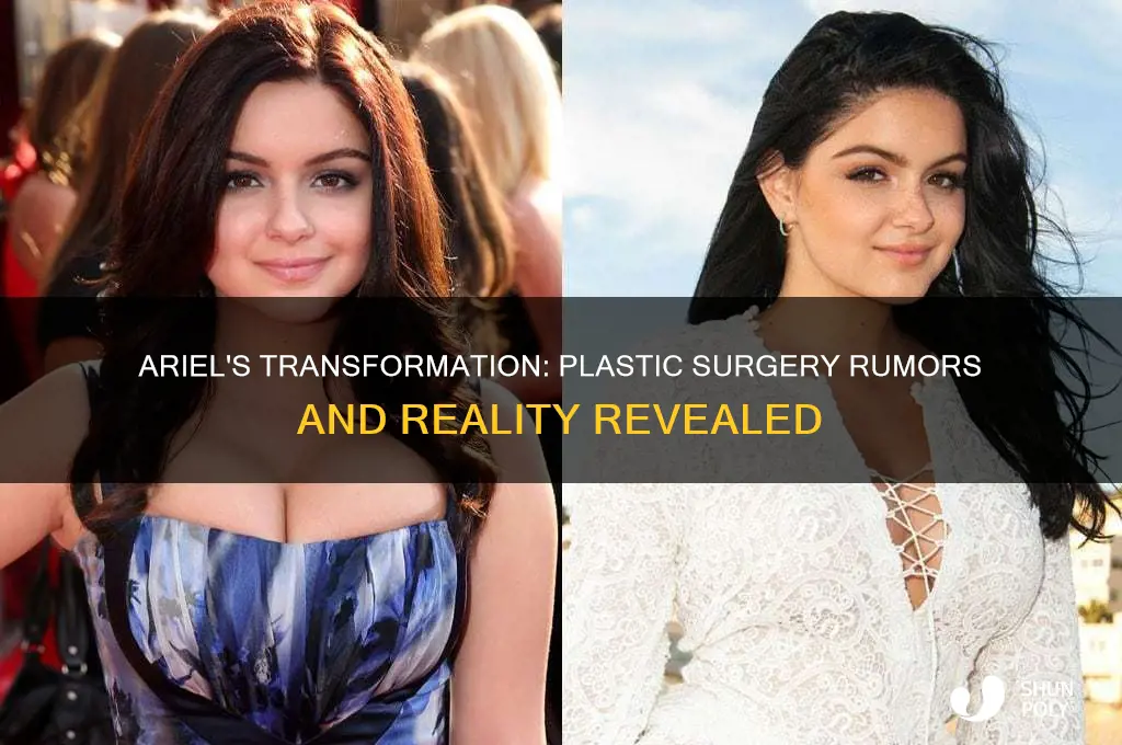 did ariel get plastic surgery