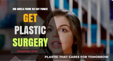 Ariela's Transformation: Plastic Surgery Rumors on 90 Day Fiancé
