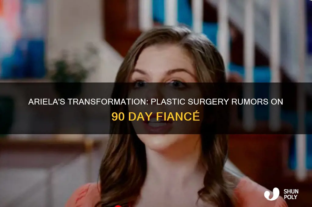 did ariela from 90 day fiance get plastic surgery