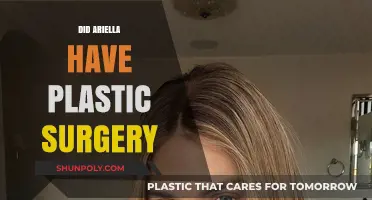 Ariella's Transformation: Unveiling the Truth About Her Plastic Surgery