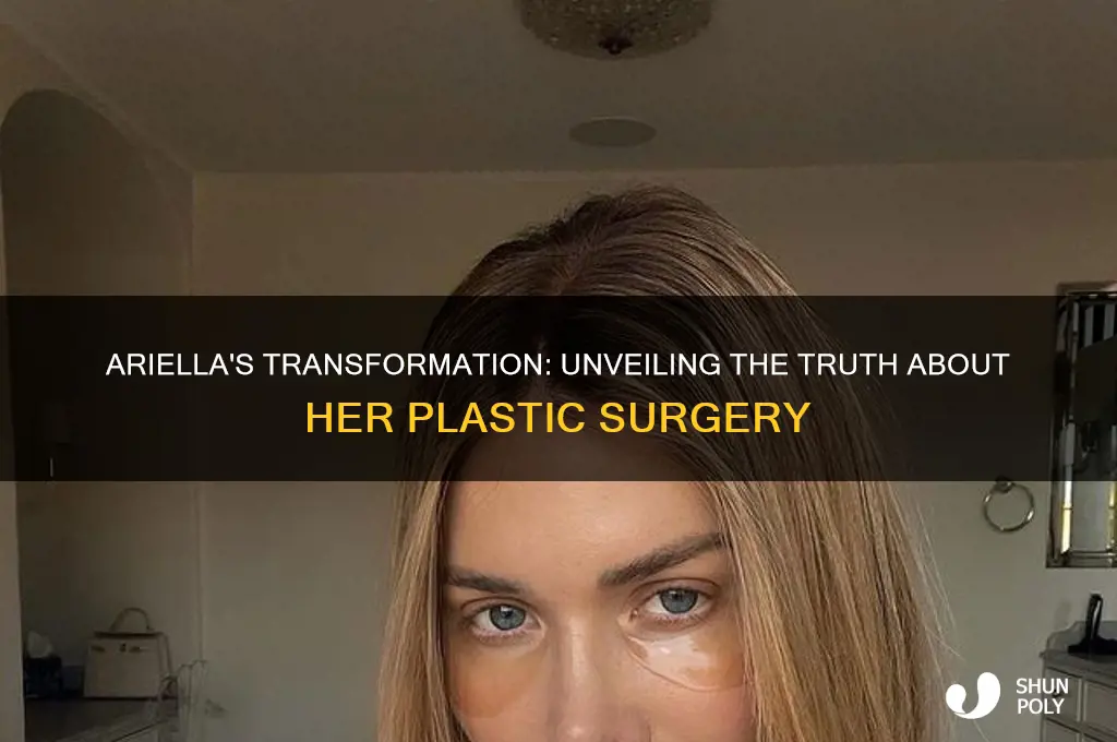 did ariella have plastic surgery