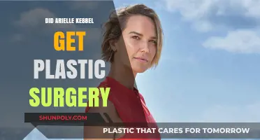 Arielle Kebbel's Transformation: Plastic Surgery Rumors Explored and Debunked