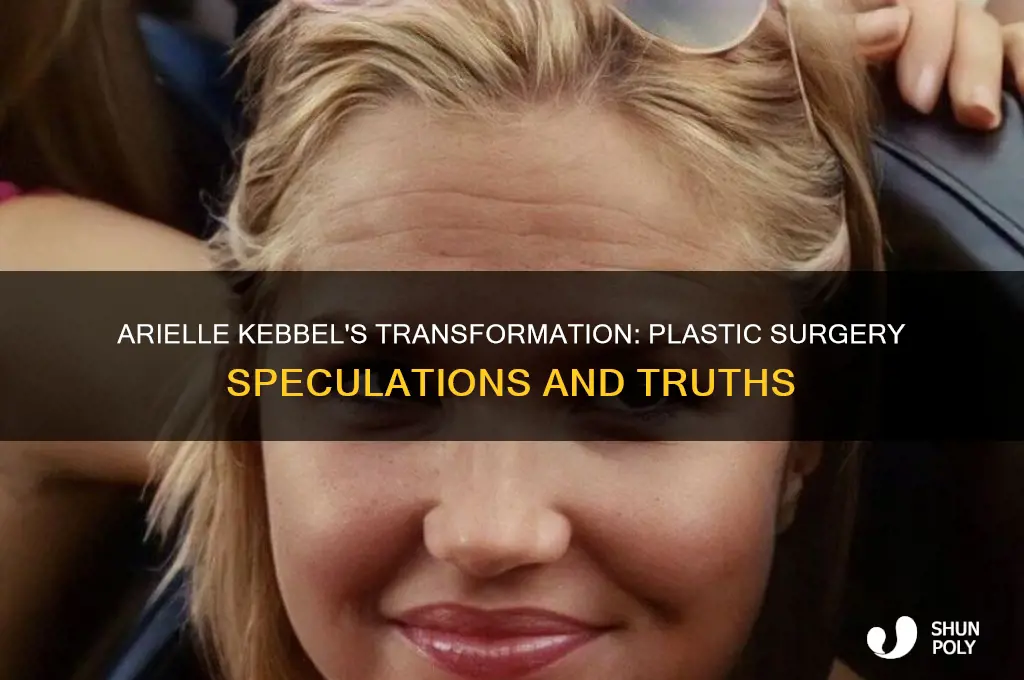 did arielle kebble have plastic surgery