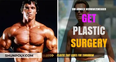 Arnold Schwarzenegger's Transformation: Plastic Surgery Rumors Explored
