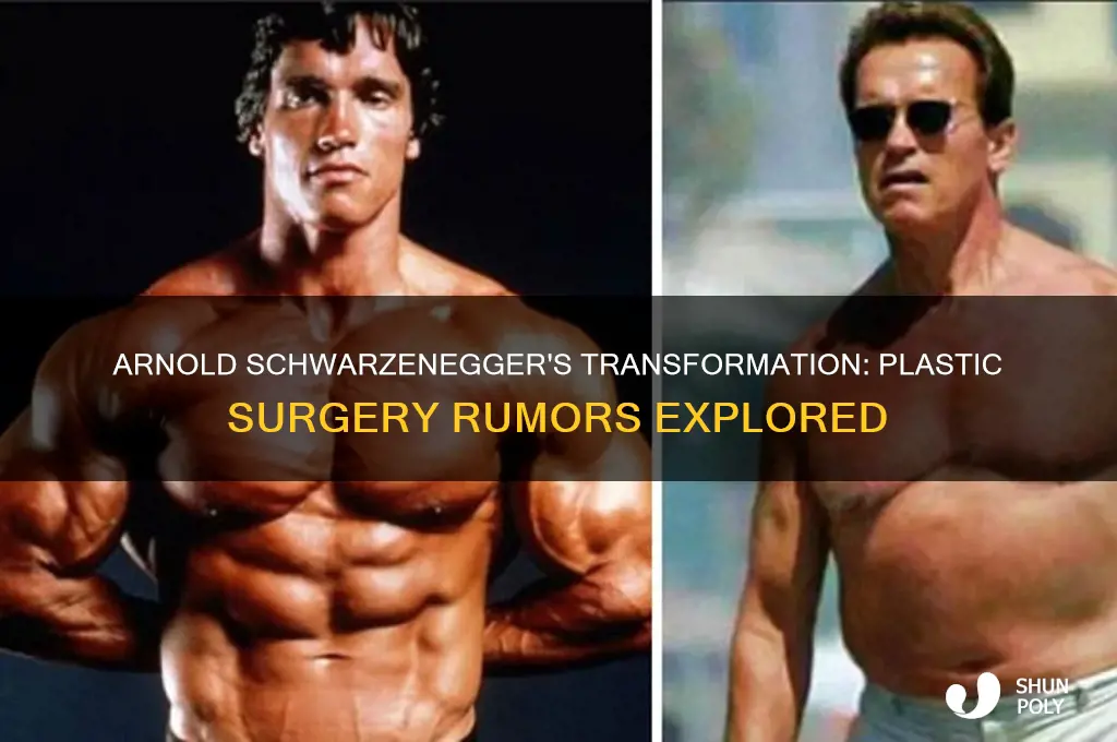 did arnold schwarzenegger get plastic surgery
