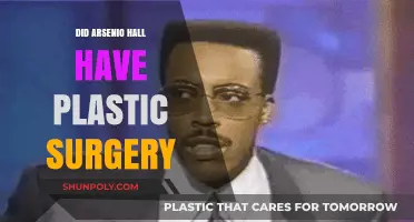 Arsenio Hall Plastic Surgery: Fact-Checking the Transformation Rumors