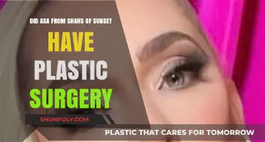 Asa Soltan Rahmati's Transformation: Plastic Surgery Rumors Explored