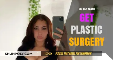 Did Ash Kaash Undergo Plastic Surgery? Unveiling the Truth