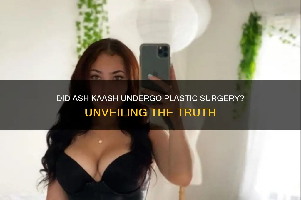 did ash kaash get plastic surgery
