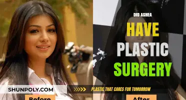 Did Ashea Undergo Plastic Surgery? Unveiling the Truth and Speculations