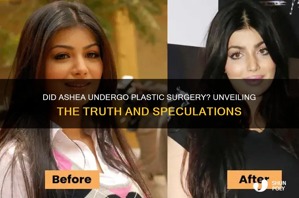 did ashea have plastic surgery