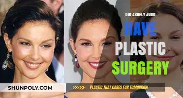 Ashley Judd's Transformation: Plastic Surgery Speculations and Truths Revealed