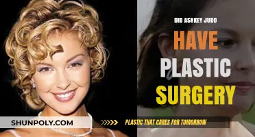 Ashley Judd's Transformation: Plastic Surgery Speculations and Truths Revealed