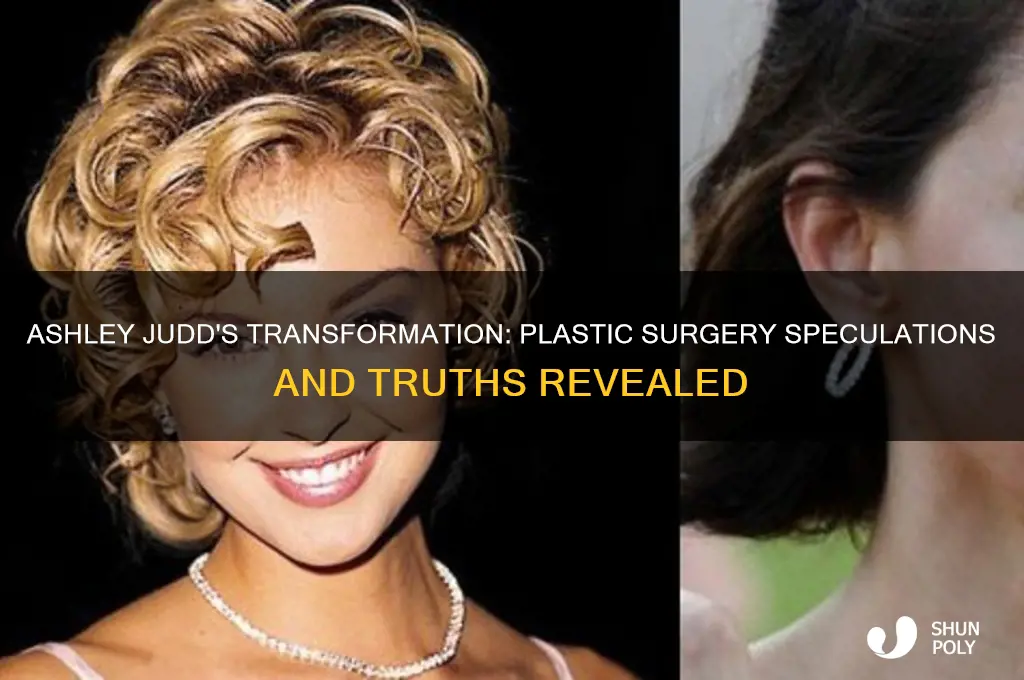 did ashkey judd have plastic surgery