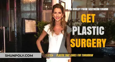 Ashley's Transformation: Southern Charm Star's Plastic Surgery Speculations