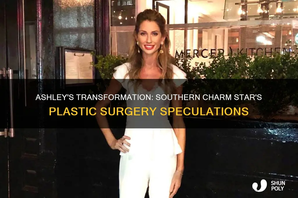 did ashley from southern charm get plastic surgery