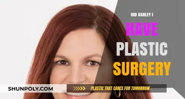 Ashley I's Transformation: Plastic Surgery Rumors and Reality Revealed