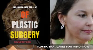 Ashley Judd's Transformation: Plastic Surgery Rumors and Reality Revealed