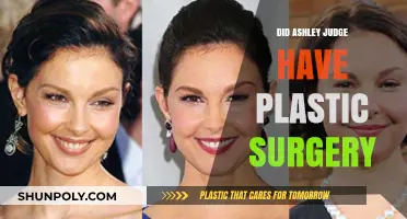 Ashley Judge Plastic Surgery: Fact-Checking the Rumors and Speculations