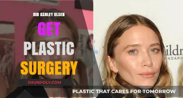 Ashley Olsen Plastic Surgery: Fact or Fiction? Unveiling the Truth