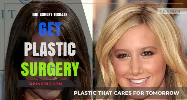 Ashley Tisdale's Transformation: Plastic Surgery Rumors Explored