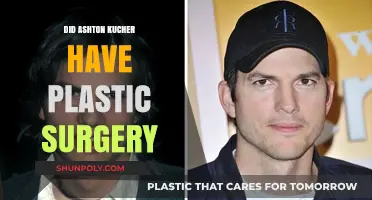 Ashton Kutcher's Transformation: Plastic Surgery Rumors Explored