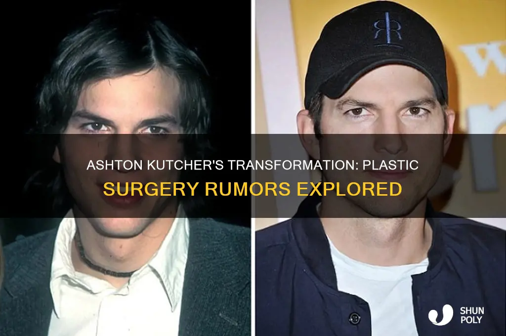 did ashton kucher have plastic surgery