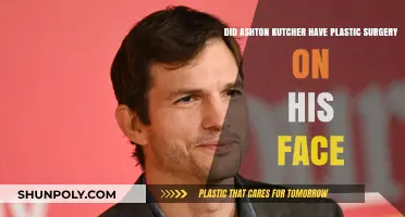 Ashton Kutcher's Face: Natural or Plastic Surgery Transformation?