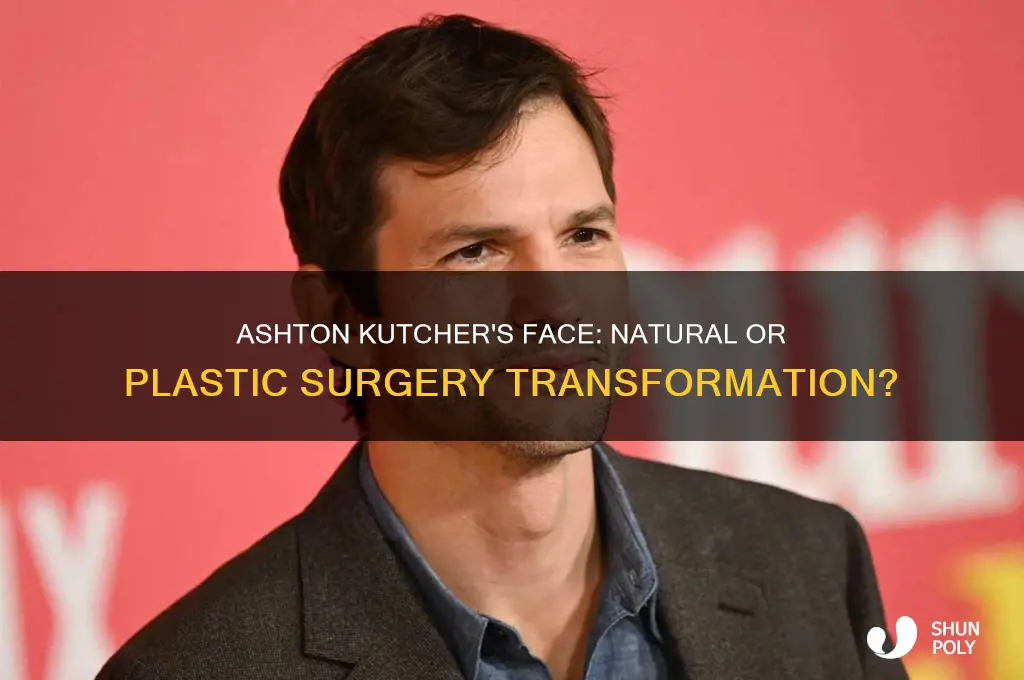 did ashton kutcher have plastic surgery on his face