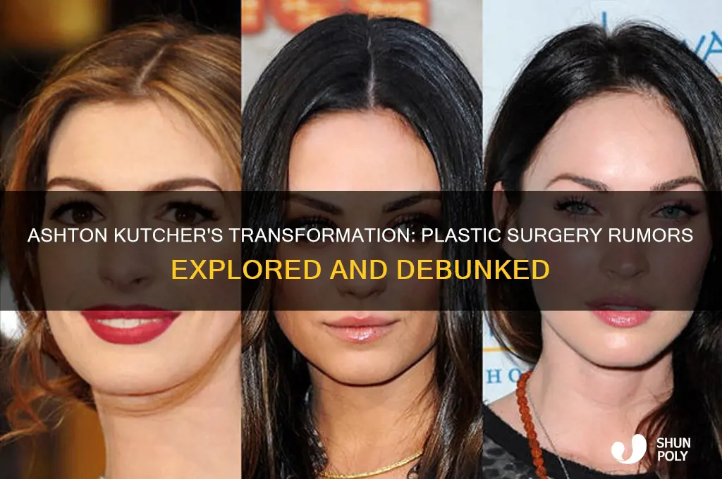 did ashton kutcher have plastic surgery